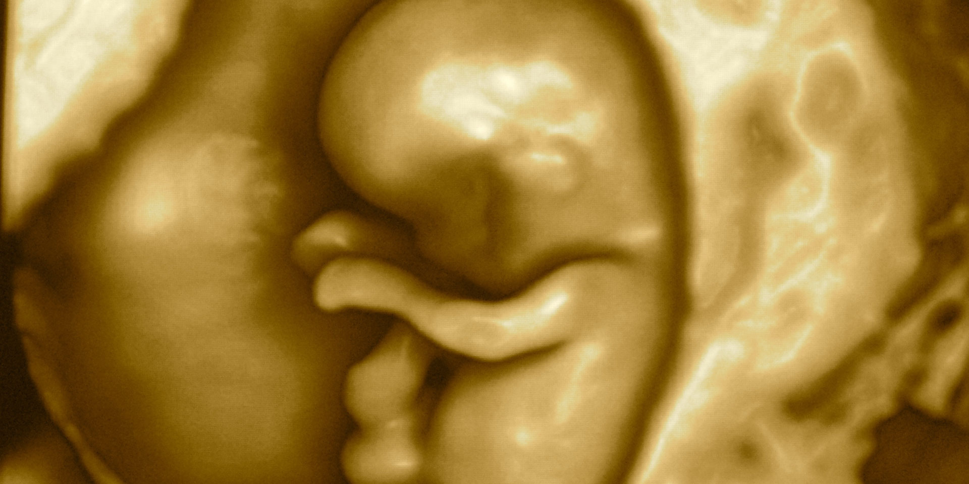 Aborto spontaneo: dati statistici